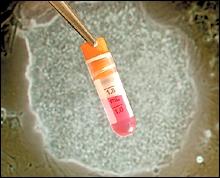 Stem cell ampoule (JPG)
