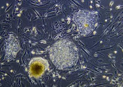 Undifferentiated stem cells (JPG)